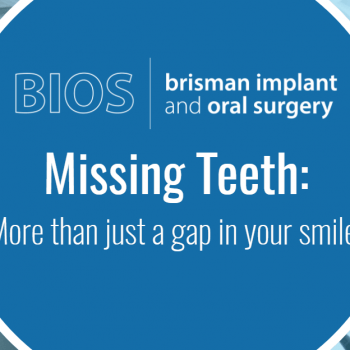 Missing teeth implants