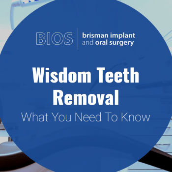 Wisdom teeth removal