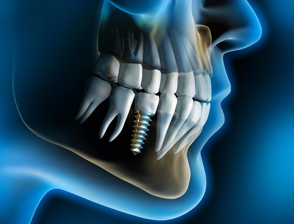 tmj treatment new york city